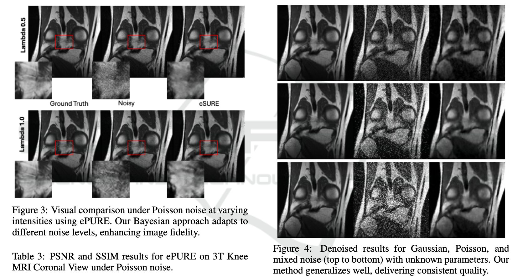 Thumbnail for From Noise Estimation to Restoration: A Unified Diffusion and Bayesian Risk Approach for Unsupervised Denoising