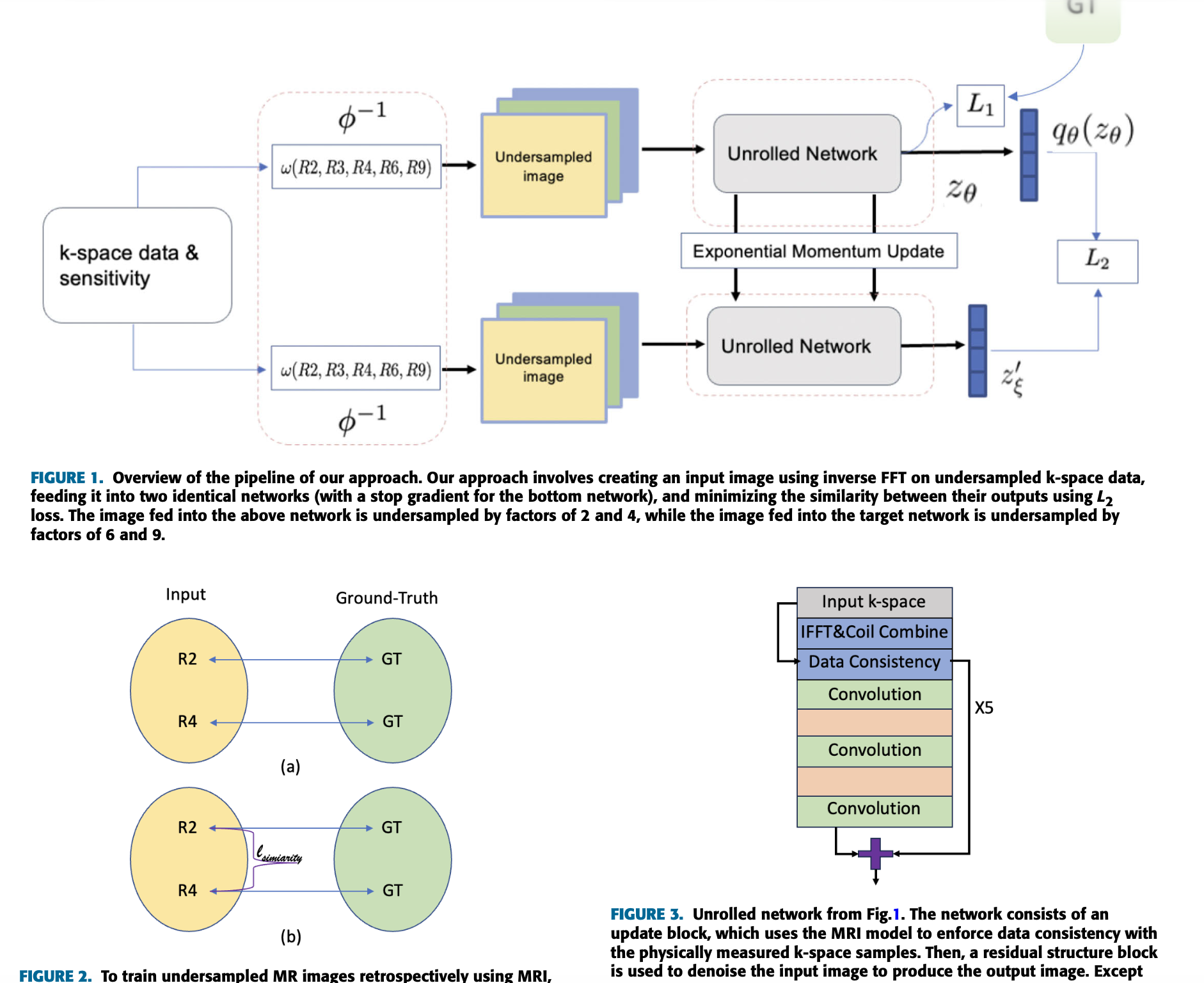Thumbnail for Learning From Oversampling: A Systematic Exploitation of Oversampling to Address Data Scarcity Issues in Deep Learning-Based MRI Reconstruction