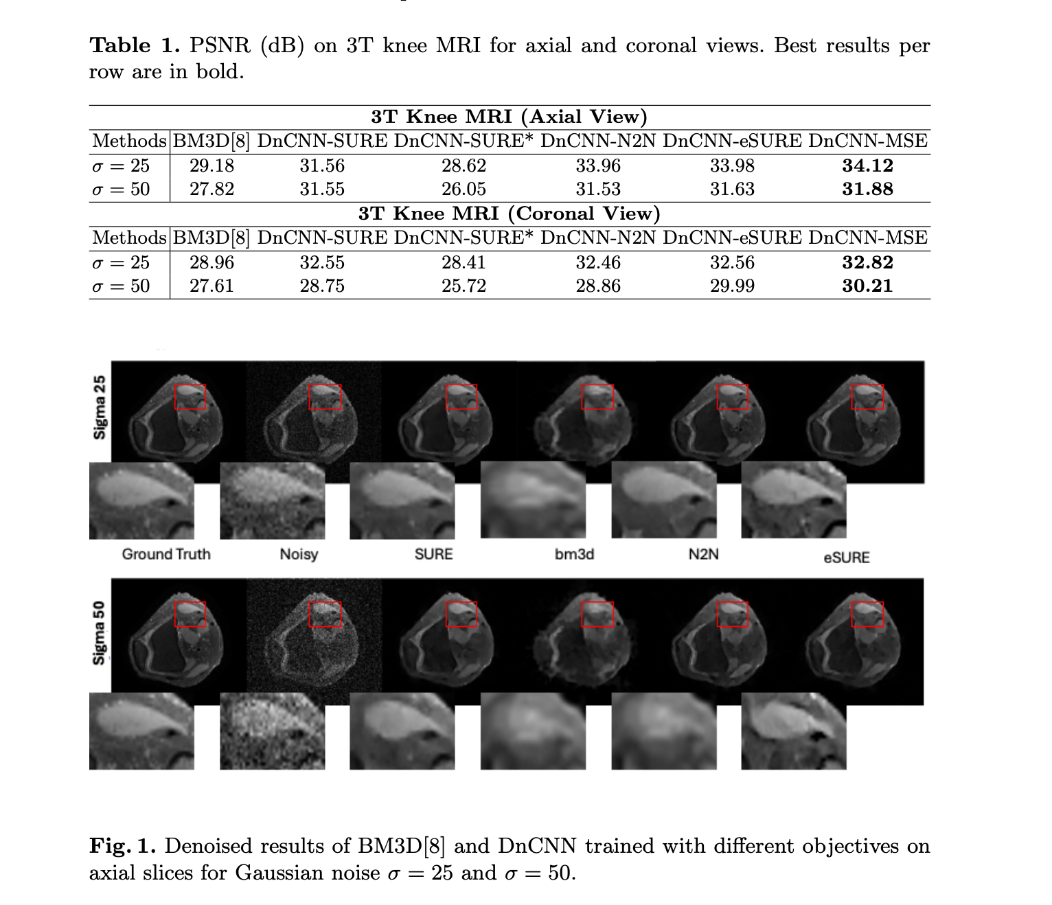 Thumbnail for Adaptive Extensions of Unbiased Risk Estimators for Unsupervised MRI Denoising